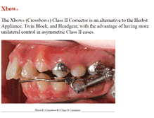 Tablet Screenshot of crossboworthodontic.com